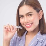 Straightening Teeth Made Simple: Unveiling Invisalign
